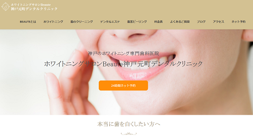 神戸でホワイトニングがおすすめのクリニック7選 安い値段で白い歯に 神戸lovers