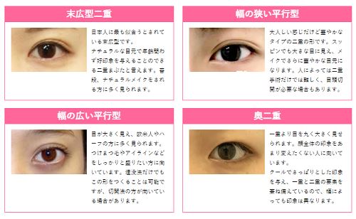 神戸で二重整形がおすすめの美容外科7選 安いと人気のクリニックはここ 神戸lovers