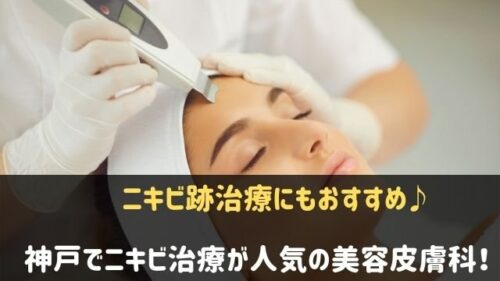 神戸でニキビ治療がおすすめの美容皮膚科