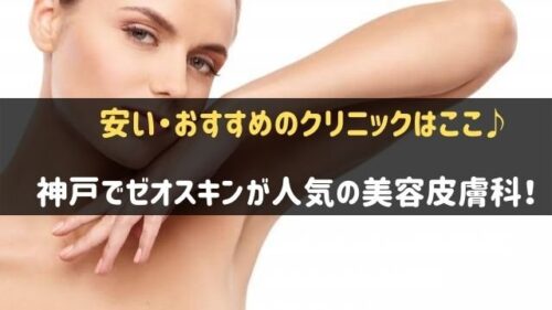 神戸でゼオスキンがおすすめの美容皮膚科